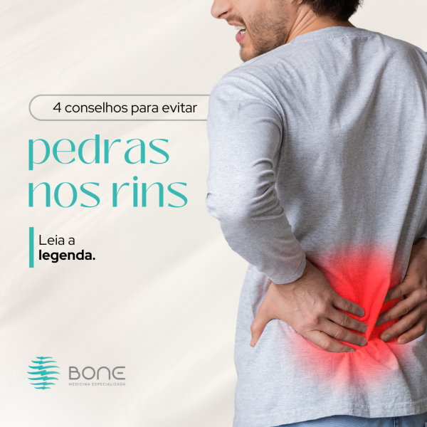 4 Conselhos para evitar pedra nos rins 4 Conselhos para evitar pedra nos rins